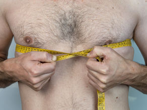 Gynecomastia SurgeryMale Breast Reduction Surgery in TURKEY ANTALYA